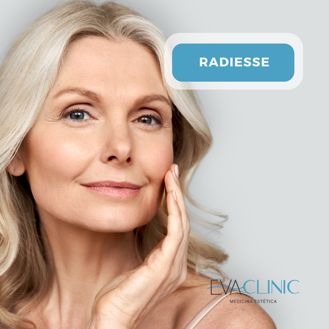 Bioestimulador (Radiesse)