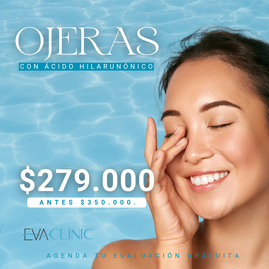 Relleno de ojeras