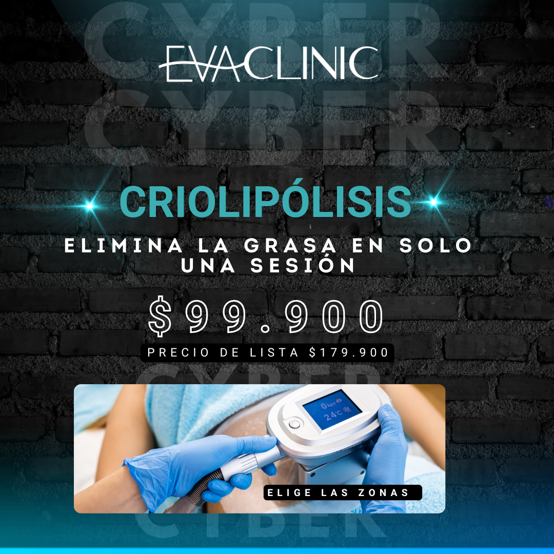 CRIOLIPOLISIS CON COOLTECH