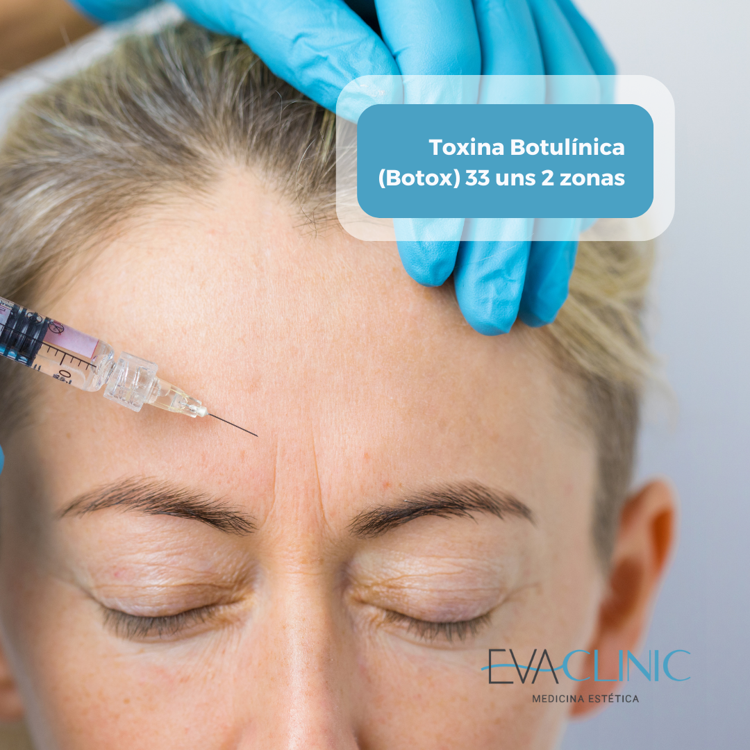 Toxina Botulínica (Botox) 33 Unds 2 Zonas