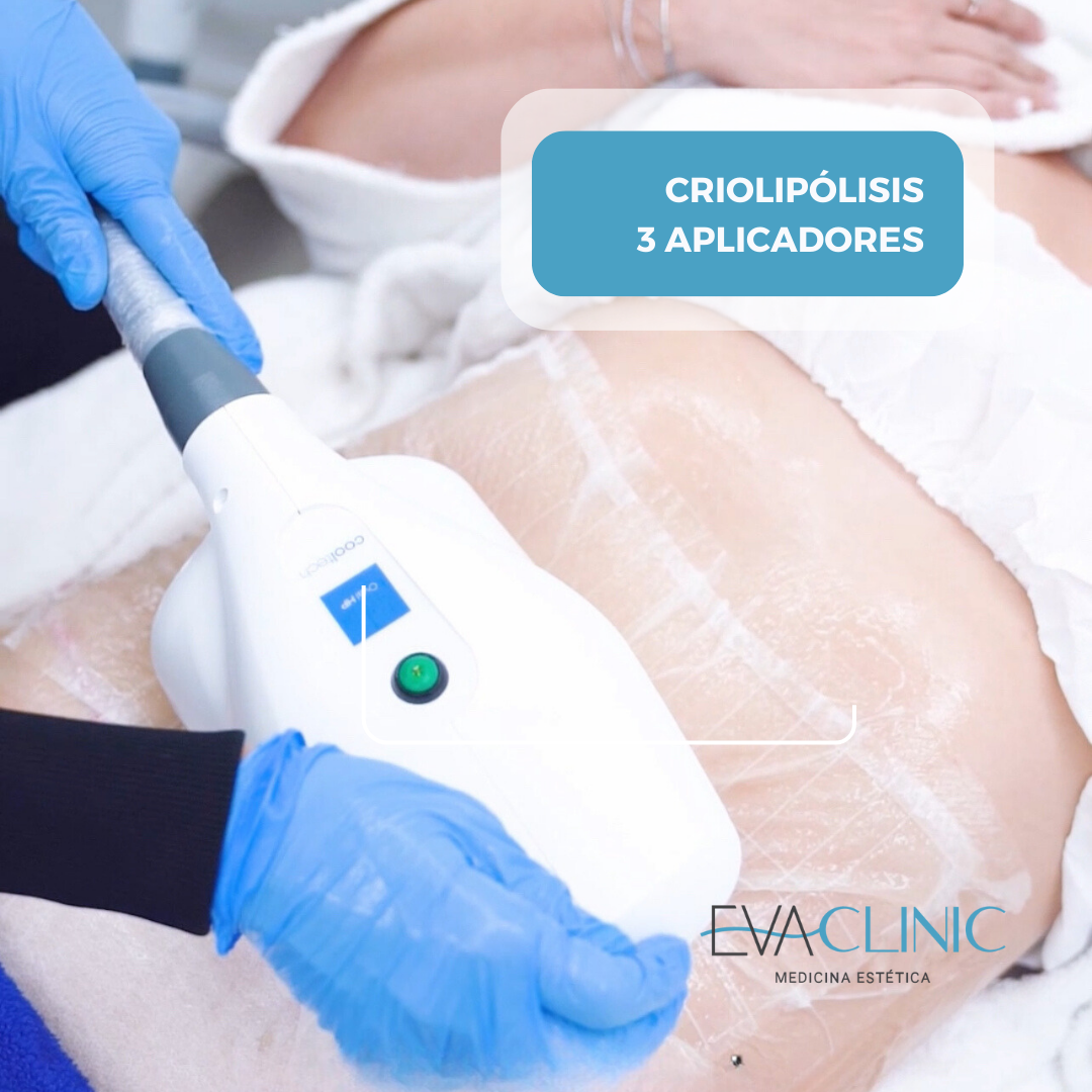 3 Aplicadores   Criolipolisis Coolltech
