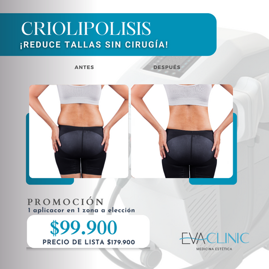 CRIOLIPOLISIS (Con Cooltech)