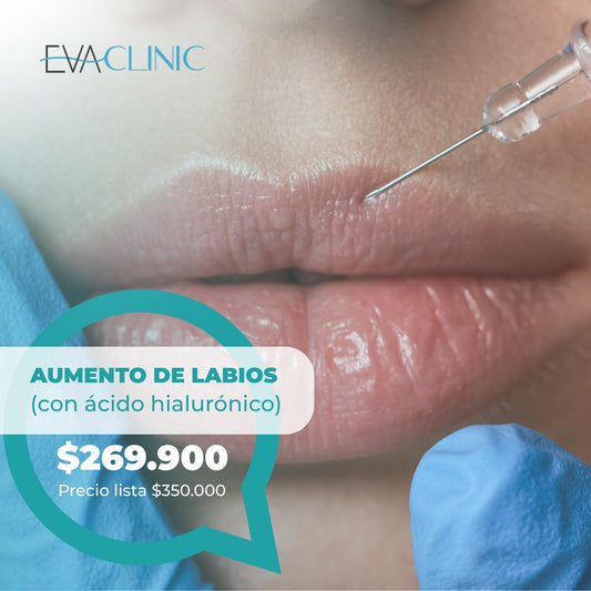 AUMENTO DE LABIOS