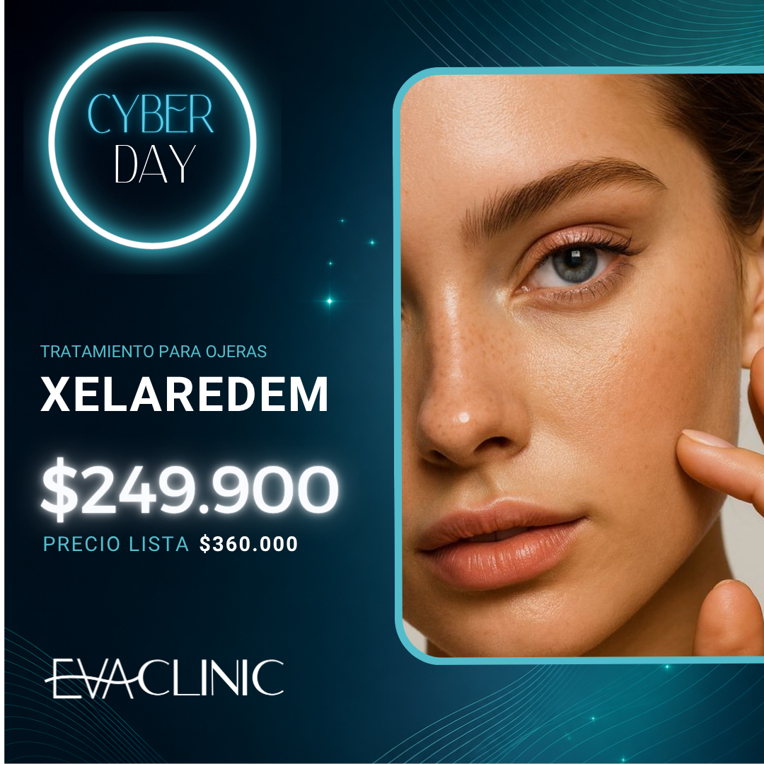 XELAREDEM (tratamiento para ojeras)