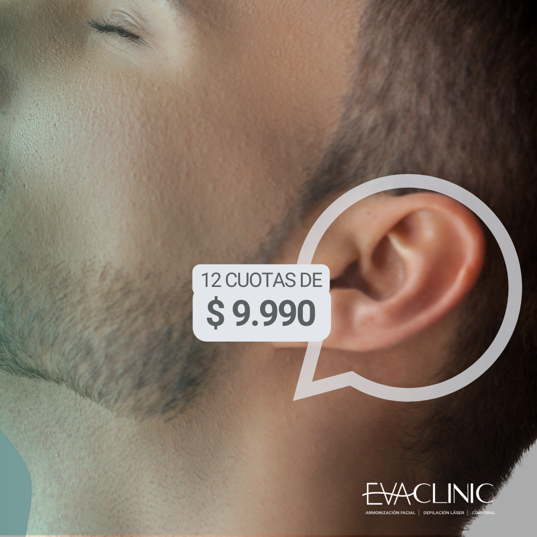 Oreja
